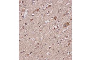 Immunohistochemistry (Paraffin-embedded Sections) (IHC (p)) image for anti-Voltage-Dependent Anion Channel 2 (VDAC2) (AA 51-85), (N-Term) antibody (ABIN6242882)