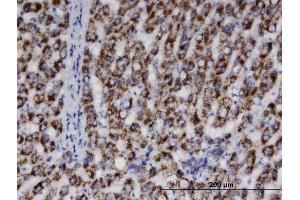 Immunoperoxidase of monoclonal antibody to ACAA1 on formalin-fixed paraffin-embedded human liver. (ACAA1 抗体  (AA 217-315))