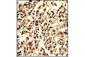 Immunohistochemistry (Paraffin-embedded Sections) (IHC (p)) image for anti-serpin Peptidase Inhibitor, Clade A (Alpha-1 Antiproteinase, Antitrypsin), Member 9 (SERPINA9) (AA 201-230), (Middle Region) antibody (ABIN954743)