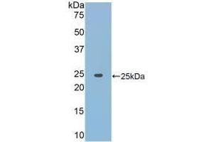 Detection of Recombinant JAK2, Rat using Polyclonal Antibody to Janus Kinase 2 (JAK2) (JAK2 抗体  (AA 916-1103))