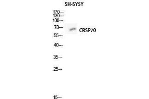Western Blot (WB) analysis of SH-SY5Y lysis using CRSP70 antibody. (MED26 抗体  (N-Term))