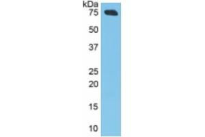 Mouse Capture antibody from the kit in WB with Positive Control: Human Skin Tissue. (ITGB6 CLIA Kit)