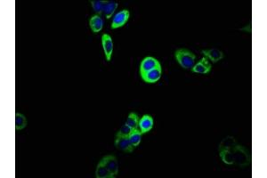 Immunofluorescence staining of PC-3 cells with ABIN7160318 at 1:133, counter-stained with DAPI.