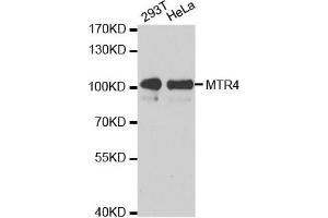 Western Blotting (WB) image for anti-Superkiller Viralicidic Activity 2-Like 2 (SKIV2L2) antibody (ABIN1876780) (MTR4 抗体)