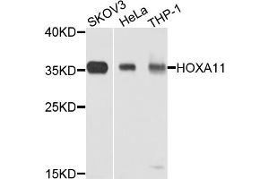 Western blot analysis of extracts of various cell lines, using HOXA11 antibody. (Homeobox A11 抗体)