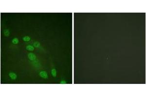Immunofluorescence analysis of HeLa cells, using NF-kappaB p65 (Ab-310) Antibody. (NF-kB p65 抗体  (AA 275-324))