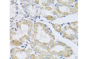 Immunohistochemistry of paraffin-embedded Human stomach using ATPIF1 Polyclonal Antibody at dilution of 1:100 (40x lens). (ATPase Inhibitory Factor 1 抗体)