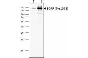 Western Blotting (WB) image for anti-Epidermal Growth Factor Receptor (EGFR) (pTyr1068) antibody (ABIN2666246) (EGFR 抗体  (pTyr1068))
