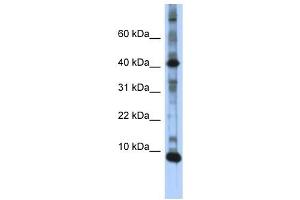 LSM6 antibody used at 1 ug/ml to detect target protein. (LSM6 抗体)