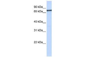 Transportin 2 antibody used at 1 ug/ml to detect target protein. (TNPO2 抗体)