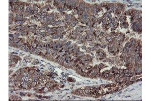 Image no. 5 for anti-Diphthamide Biosynthesis Protein 2 (DPH2) antibody (ABIN1497893)