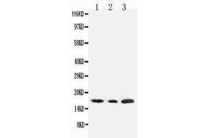 Anti-SDHC antibody, Western blotting Lane 1: Rat Liver Tissue Lysate Lane 2: HELA Tissue Lysate Lane 3: JURKAT Cell Lysate (SDHC 抗体  (N-Term))