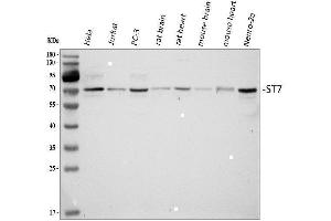 Western blot analysis of ST7 using anti-ST7 antibody (ABIN4886732). (ST7 抗体  (Middle Region))