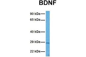 Host:  Rabbit  Target Name:  BDNF  Sample Tissue:  Human ACHN  Antibody Dilution:  1. (BDNF 抗体  (Middle Region))