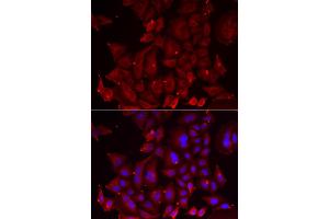 Immunofluorescence analysis of U2OS cells using PANX1 antibody. (PANX1 抗体)
