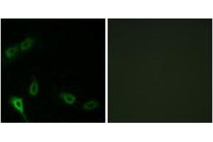 Immunofluorescence analysis of A549 cells, using MARK2 Antibody. (MARK2 抗体  (AA 10-59))