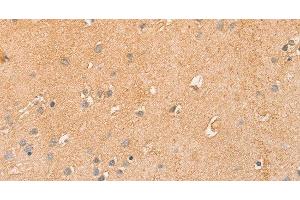 Immunohistochemistry of paraffin-embedded Human brain using CCL16 Polyclonal Antibody at dilution of 1:50 (CCL16 抗体)
