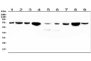 Western blot analysis of HSPA2 using anti-HSPA2 antibody (ABIN5692870).