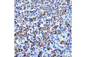 Immunohistochemistry of paraffin-embedded rat ovary using NEK2 Rabbit pAb  at dilution of 1:100 (40x lens). (NEK2 抗体  (C-Term))