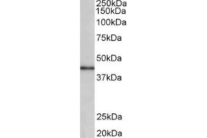 Western Blotting (WB) image for anti-Cyclin D-Type Binding-Protein 1 (CCNDBP1) (AA 322-333) antibody (ABIN1100483) (CCNDBP1 抗体  (AA 322-333))