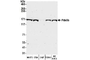 Western Blotting (WB) image for anti-PDS5, Regulator of Cohesion Maintenance, Homolog B (PDS5B) (C-Term) antibody (ABIN7453755)