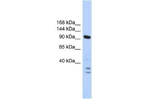WB Suggested Anti-PBRM1 Antibody Titration:  0.
