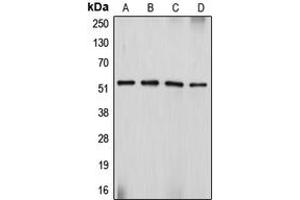 Western blot analysis of Desmin expression in Sol8 (A), HeLa (B), SJRH30 (C), PC12 (D) whole cell lysates. (Desmin 抗体  (C-Term))