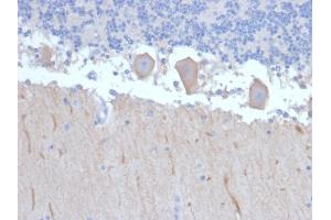 Formalin-fixed, paraffin-embedded human Brain stained with ATG5 Mouse Monoclonal Antibody (ATG5/2492). (ATG5 抗体  (AA 1-119))
