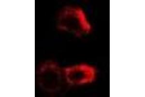 Immunofluorescent analysis of PYGB staining in MCF7 cells. (PYGB 抗体)