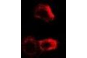 Immunofluorescent analysis of PYGB staining in MCF7 cells.