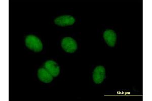 Immunofluorescence of purified MaxPab antibody to ZNF684 on HeLa cell. (ZNF684 抗体  (AA 1-378))
