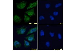 ABIN570861 Immunofluorescence analysis of paraformaldehyde fixed HeLa cells, permeabilized with 0. (NIPBL 抗体  (AA 889-902))