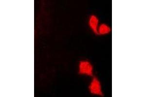 Immunofluorescent analysis of HUS1 staining in K562 cells. (HUS1 抗体)