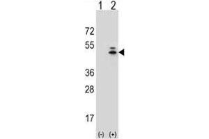 Western blot analysis of g-Actin antibody and 293 cell lysate (2 ug/lane) either nontransfected (Lane 1) or transiently transfected (2) with the ACTG1 gene. (Actin, gamma 1 抗体  (AA 188-215))