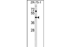 ZN Antibody (Center) (ABIN1538010 and ABIN2849144) western blot analysis in ZR-75-1 cell line lysates (35 μg/lane). (Zinc Finger and SCAN Domain Containing 31 (ZSCAN31) (AA 190-217) 抗体)