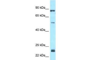 WB Suggested Anti-E2F1 Antibody Titration: 1. (E2F1 抗体  (Middle Region))