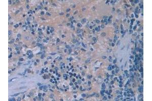 Detection of IL6 in Rat Spleen Tissue using Monoclonal Antibody to Interleukin 6 (IL6) (IL-6 抗体  (AA 21-211))