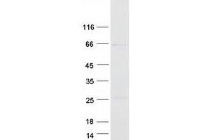 Western Blotting (WB) image for Methyltransferase Like 14 (METTL14) protein (Myc-DYKDDDDK Tag) (ABIN2725886)