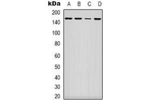 Western blot analysis of ARHGAP23 expression in A549 (A), NIH3T3 (B), HEK293T (C), mouse heart (D) whole cell lysates. (ARHGAP23 抗体)