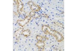 Immunohistochemistry of paraffin-embedded rat kidney using MTERFD3 antibody (ABIN5974877) at dilution of 1/100 (40x lens). (MTERFD3 抗体)