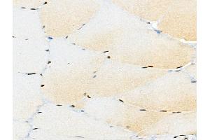 ABIN6256450 and ABIN6267096 at 1/100 staining Rat muscle tissue by IHC-P. (BCL9L 抗体  (pSer915))