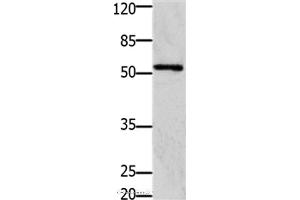 Western blot analysis of 293T cell, using GFRA1 Polyclonal Antibody at dilution of 1:1250 (GFRA1 抗体)