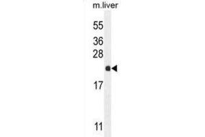 Western Blotting (WB) image for anti-Ribulose-5-Phosphate-3-Epimerase-Like (RPEL1) antibody (ABIN2995143) (Ribulose-5-Phosphate-3-Epimerase-Like (RPEL1) 抗体)