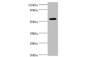 Western blot All lanes: TSEN2 antibody at 5 μg/mL + 293T whole cell lysate Secondary Goat polyclonal to rabbit IgG at 1/10000 dilution Predicted band size: 54, 52, 50, 48, 46 kDa Observed band size: 54 kDa (TSEN2 抗体  (AA 1-220))