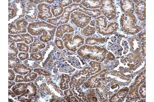 IHC-P Image MCD antibody [N2C1], Internal detects MCD protein at cytosol on mouse kidney by immunohistochemical analysis. (MLYCD 抗体)