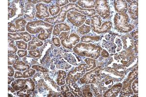 IHC-P Image MCD antibody [N2C1], Internal detects MCD protein at cytosol on mouse kidney by immunohistochemical analysis. (MLYCD 抗体)