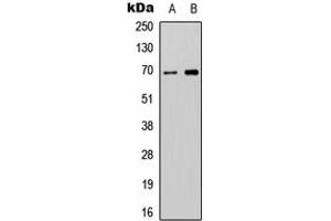 Western blot analysis of ATG16L2 expression in SHSY5Y (A), NIH3T3 (B) whole cell lysates. (ATG16L2 抗体  (Center))