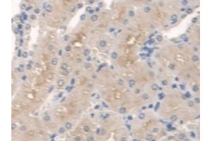 Detection of SPTLC1 in Mouse Kidney Tissue using Polyclonal Antibody to Serine Palmitoyltransferase, Long Chain Base Subunit 1 (SPTLC1) (SPTLC1 抗体  (AA 143-473))
