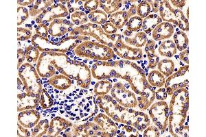 Immunohistochemistry analysis of paraffin-embedded Mouse kidney cancer using COX4I1 Polyclonal Antibody at dilution of 1:200. (COX IV 抗体)