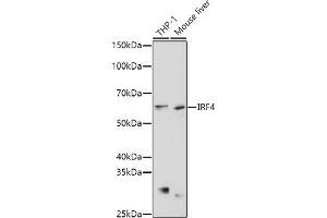 Western blot analysis of extracts of various cell lines, using IRF4 antibody (ABIN1680506, ABIN3015186, ABIN3015187 and ABIN6213873) at 1:1000 dilution. (IRF4 抗体  (AA 150-350))